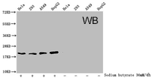 Histone Antibodies WB01