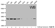 Histone Antibodies WB02