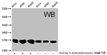 Histone Antibodies WB03