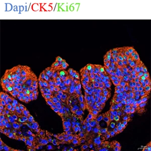 DAPI/CK5/Ki‑67 Fluorescence Labeling