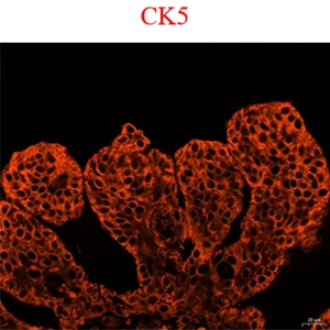 CK5 Single‑Channel Staining