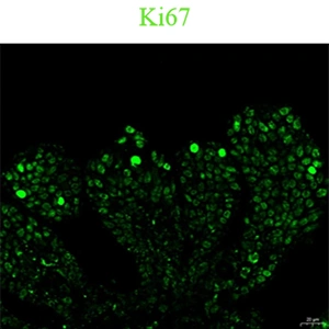 Ki‑67 Proliferation Marker, Single‑Channel