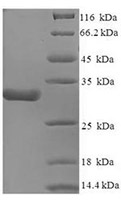 CSB-EP004407HU1 SDS-page