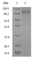 NEFL recombinant protein SDS