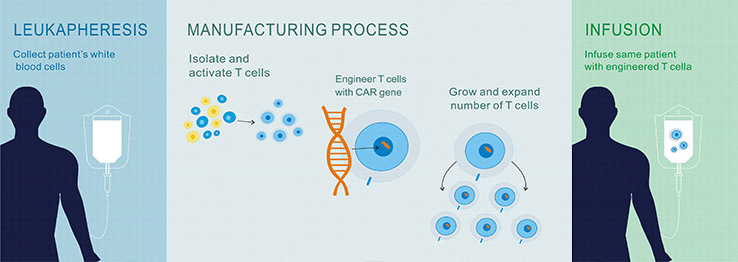 the processes of CAR-T cell therapy