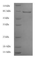 RVG recombinant protein SDS