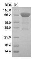 The SDS-PAGE of Recombinant Human CD133