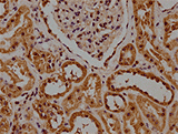 TagControl Antibodies ValidationIHC