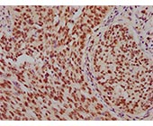 SNRPB2 Antibody IHC