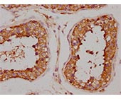 KATNAL2 Antibody IHC