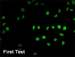 HIST1H4A Antibody Applied in IF 01