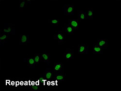 HIST1H4A Antibody Applied in IF 02