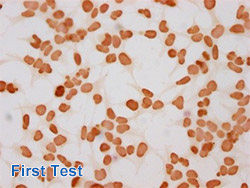 Acetyl-HIST1H3A Antibody Applied in IHC 01