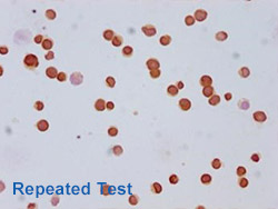 Acetyl-HIST1H3A Antibody Applied in IHC 02