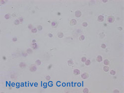 Acetyl-HIST1H3A Antibody Applied in IHC 03