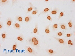 Acetyl-HIST1H3A Antibody Applied in IHC 04