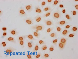 Acetyl-HIST1H3A Antibody Applied in IHC 05