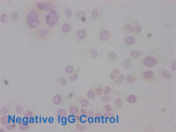 Acetyl-HIST1H3A Antibody Applied in IHC 06