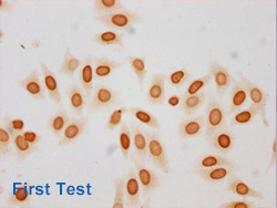 Acetyl-HIST1H3A Antibody Applied in IHC 07