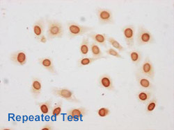 Acetyl-HIST1H3A Antibody Applied in IHC 08