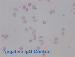 Acetyl-HIST1H3A Antibody Applied in IHC 09