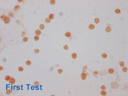 Acetyl-HIST1H3A Antibody Applied in IHC 10