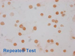 Acetyl-HIST1H3A Antibody Applied in IHC 11