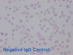 Acetyl-HIST1H3A Antibody Applied in IHC 12