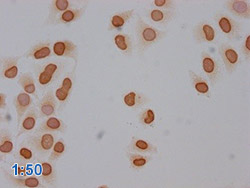 Acetyl-HIST1H3A Antibody Applied in IHC 13