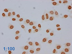 Acetyl-HIST1H3A Antibody Applied in IHC 14