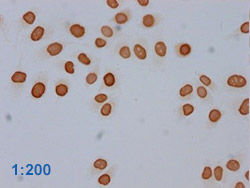 Acetyl-HIST1H3A Antibody Applied in IHC 15