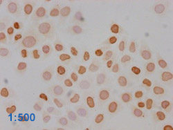 Acetyl-HIST1H3A Antibody Applied in IHC 16