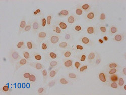 Acetyl-HIST1H3A Antibody Applied in IHC 17