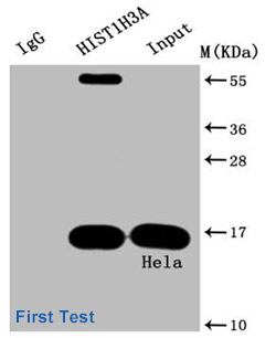 Acetyl-HIST1H3A Antibody Applied in IP 01