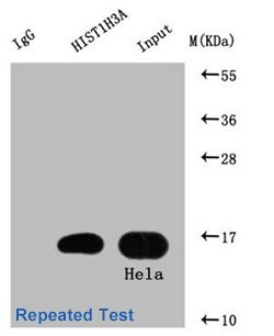 Acetyl-HIST1H3A Antibody Applied in IP 02