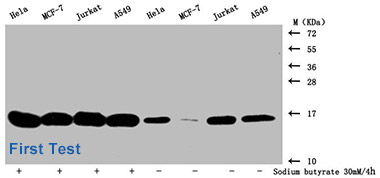 Acetyl-HIST1H3A Antibody Applied in WB 01
