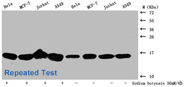 Acetyl-HIST1H3A Antibody Applied in WB 02