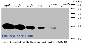 Acetyl-HIST1H3A Antibody Applied in WB 03
