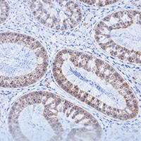 IHC