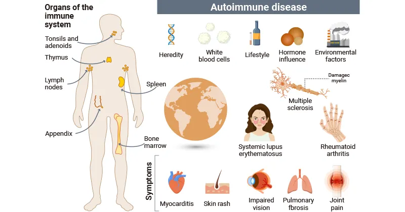 Causes and common symptoms of autoimmune diseases