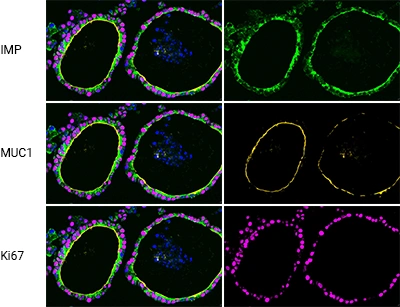 Fluorescence Sections: Functional Proteins & Proliferation Markers
