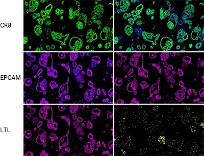 Fluorescence Sections: Epithelial & Differentiation Markers