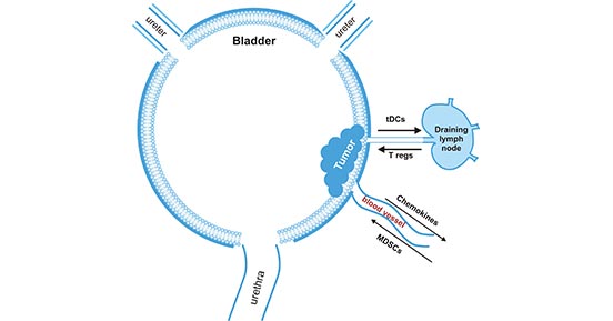 Bladder tumor-induced immune suppression promotes the escape of malignant epithelial bladder cells from the immune system