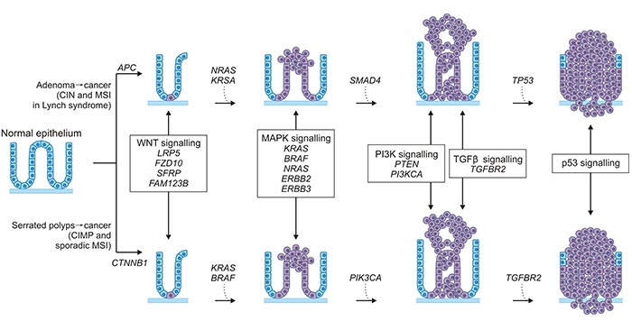 The polyp to colorectal cancer sequences