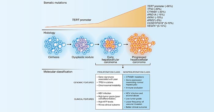 Main genetic alterations in hepatocellular carcinoma and molecular classification