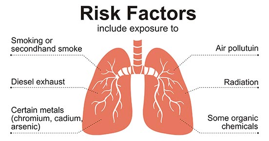 the risk factors of getting lung cancer