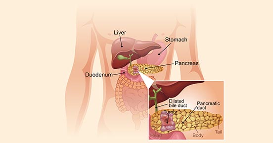 A diagram of pancreas structure