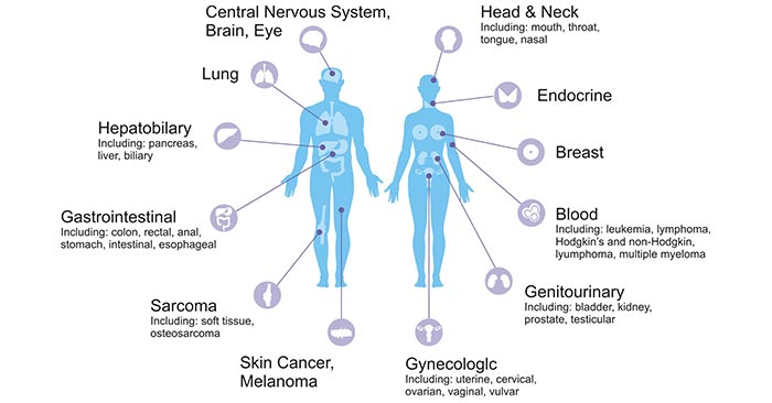 The distribution of cancers in human