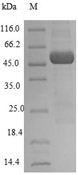 Recombinant Human NPR1 SDS