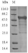 Recombinant Human ADIPOR1 SDS